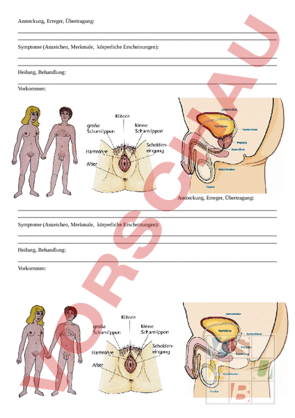 Geschlechtskrankheiten unterrichtsmaterial